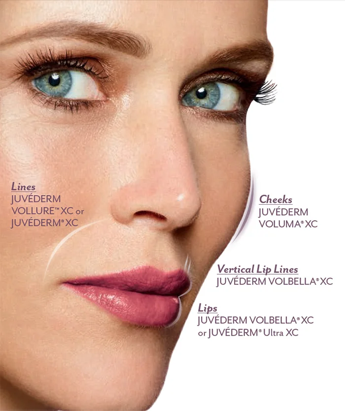 Juvederm Collection