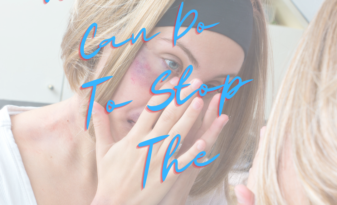 Bruise Prevention 101:  Insider Skincare Tips
