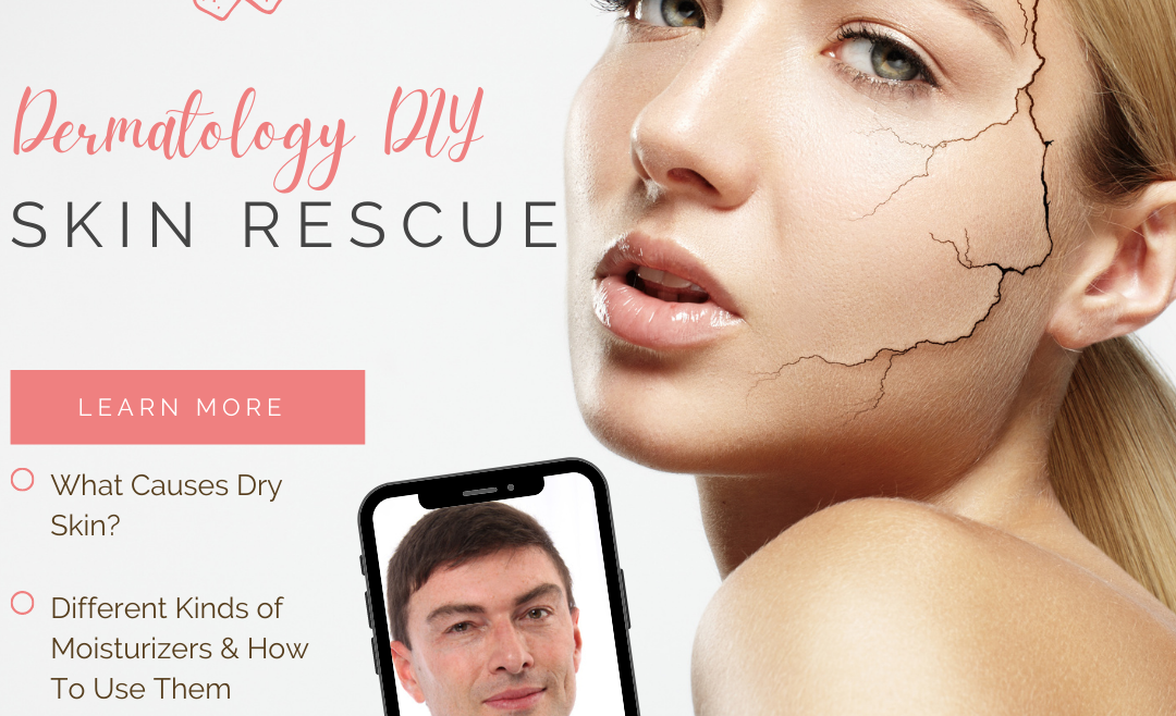 Skin Rescue: The Deal With Dry Skin
