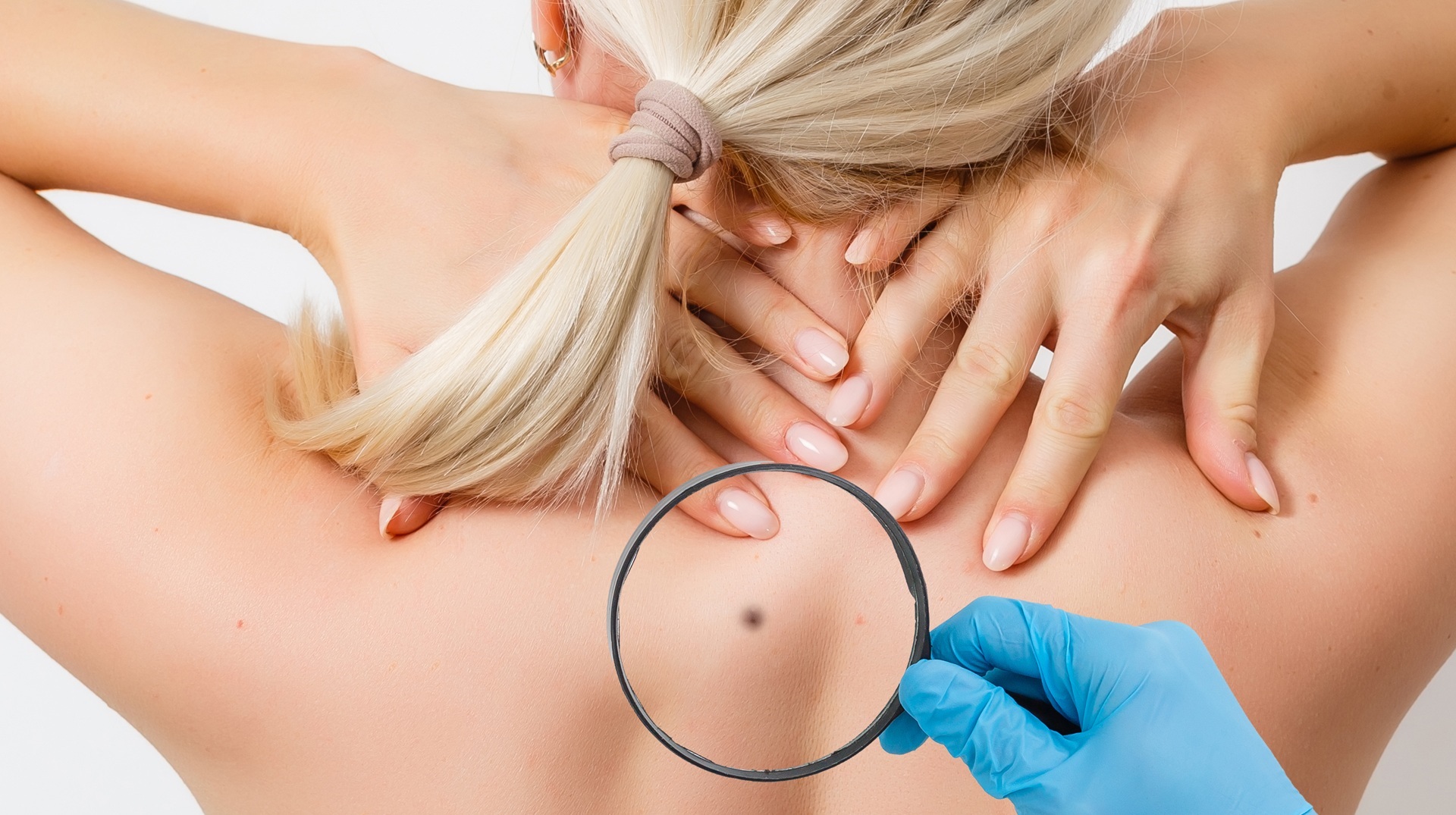 Close-up of a clinical skin examination