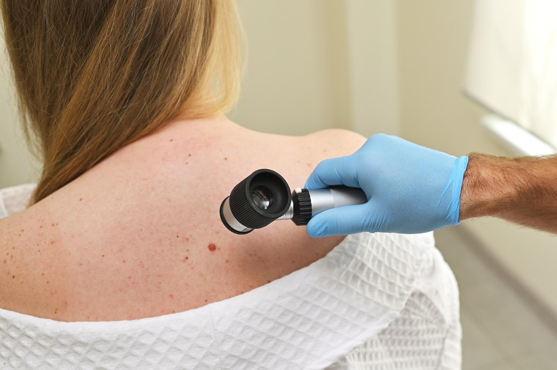 A clinician examining the skin on a patient’s back