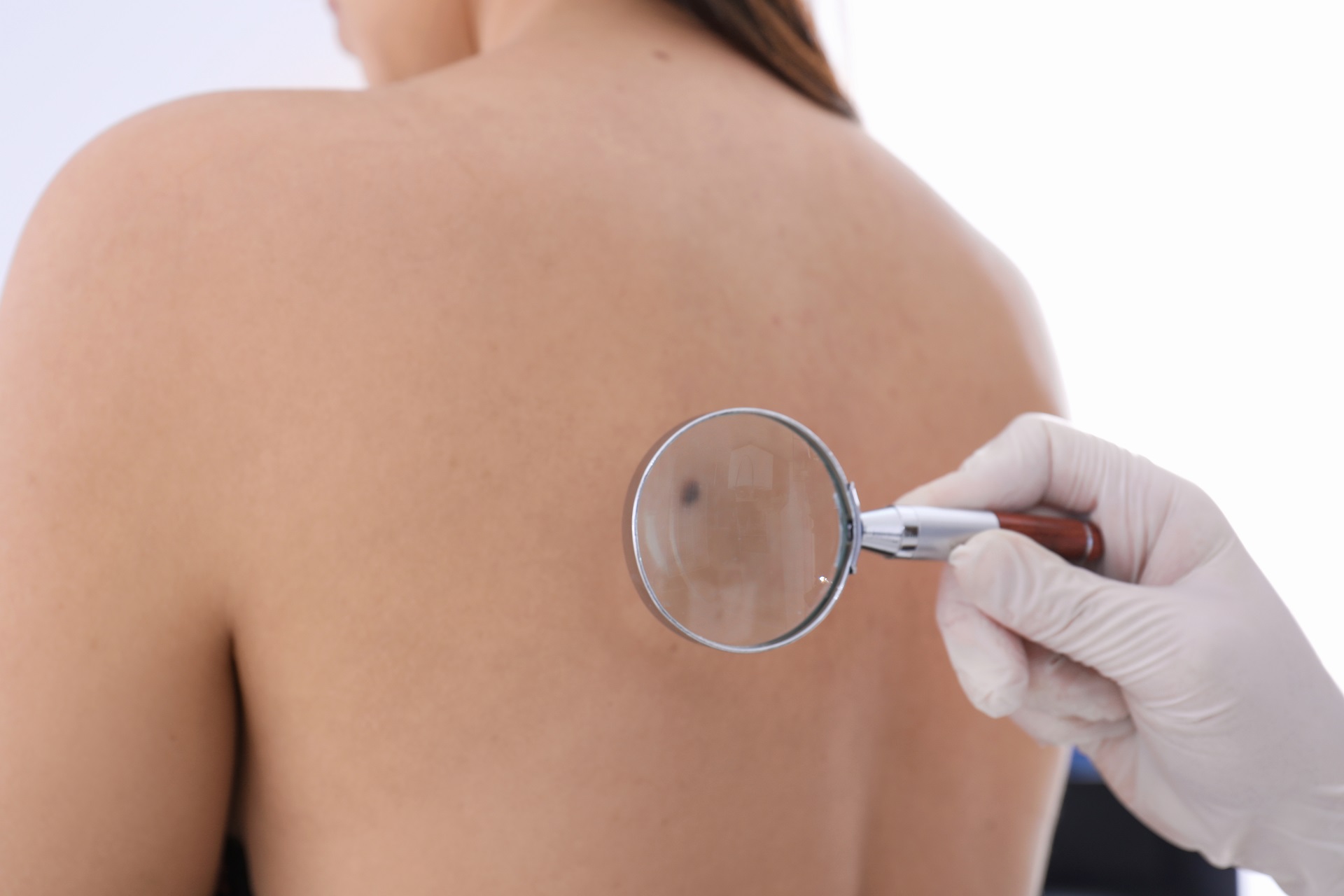 A clinician examining a skin concern